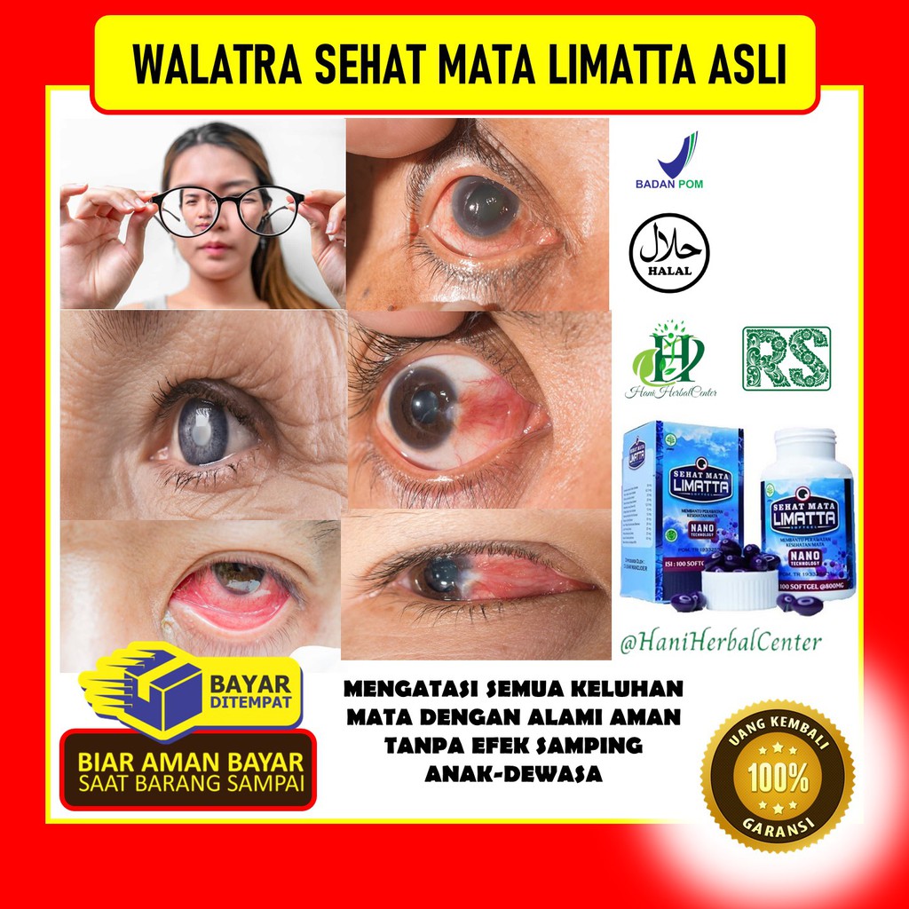 Detail Gambar Infeksi Mata Nomer 48