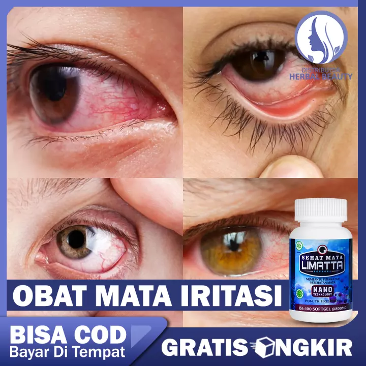 Detail Gambar Infeksi Mata Nomer 54