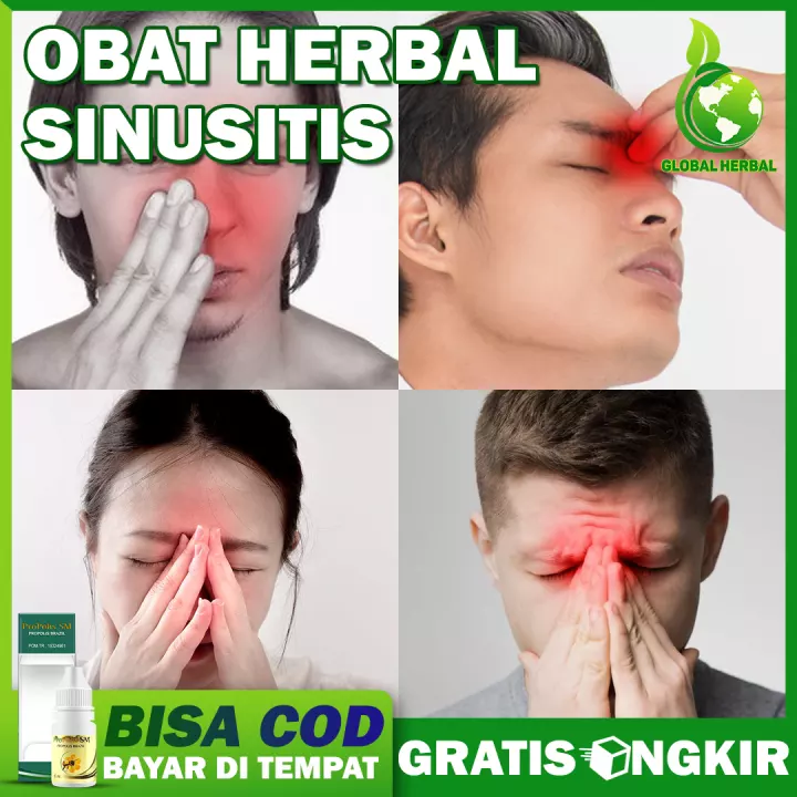 Detail Gambar Ingus Kuning Nomer 44