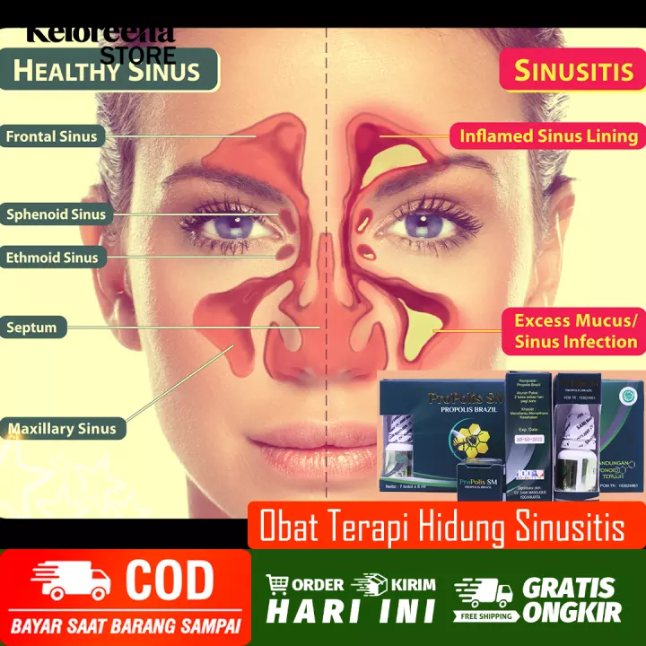 Detail Gambar Ingus Kuning Nomer 54