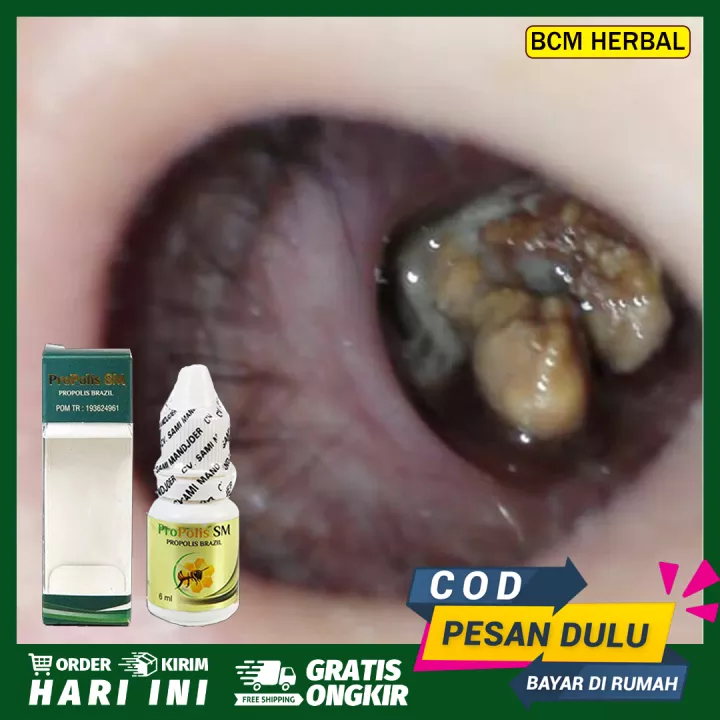 Detail Gambar Ingus Kuning Nomer 8