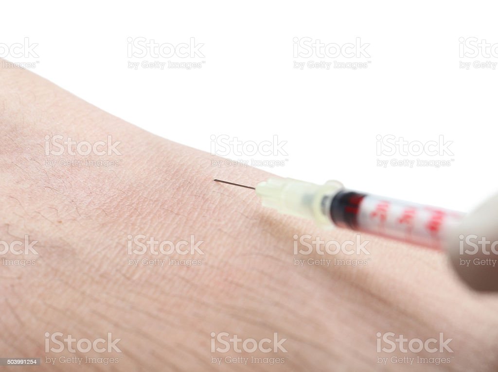 Detail Gambar Injeksi Intravena Nomer 19