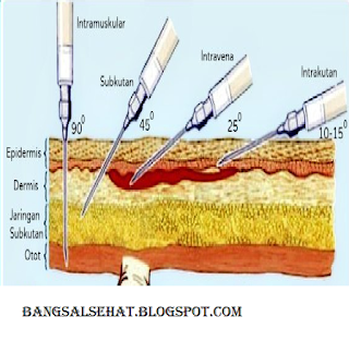 Detail Gambar Injeksi Intravena Nomer 29