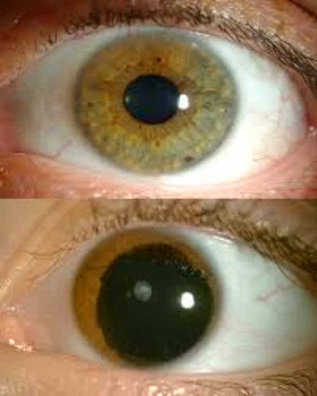 Detail Gambar Iris Mata Nomer 19