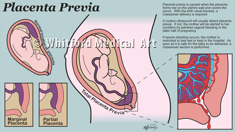 Detail Gambar Jalan Lahir Bayi Nomer 26