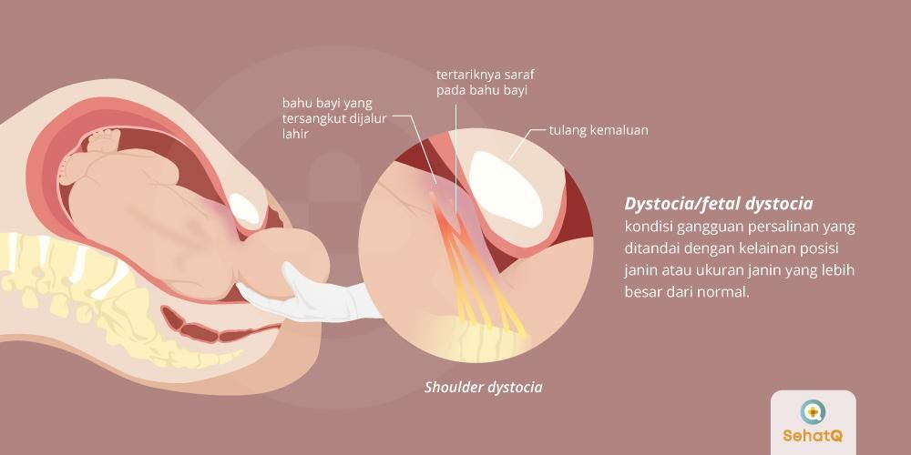 Detail Gambar Jalan Lahir Bayi Nomer 32