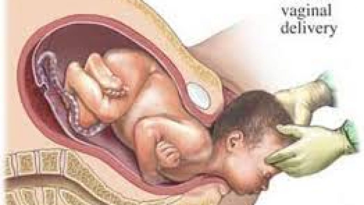 Detail Gambar Jalan Lahir Bayi Nomer 33