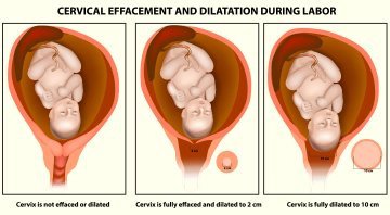 Detail Gambar Jalan Lahir Bayi Nomer 49