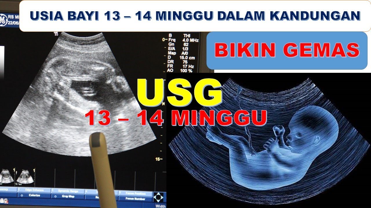 Detail Gambar Janin 13 Minggu Dalam Kandungan Nomer 12