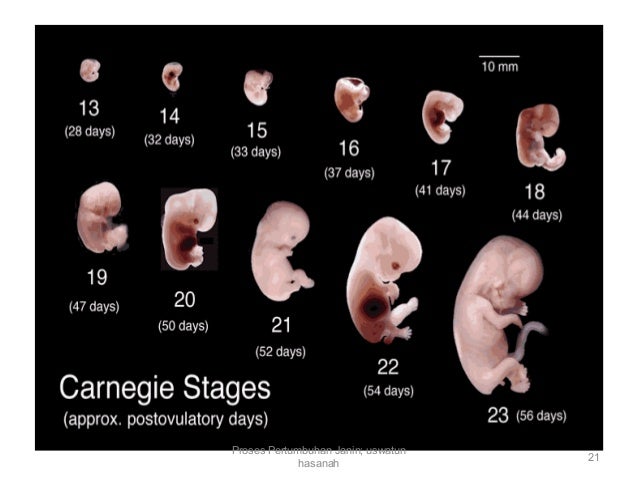 Detail Gambar Janin 17 Minggu Nomer 27