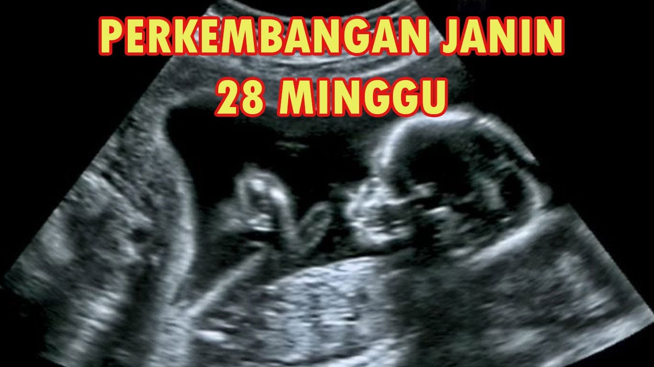 Detail Gambar Janin 28 Minggu Nomer 23