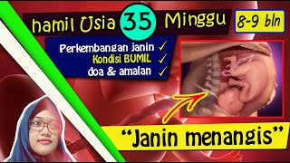 Detail Gambar Janin 35 Minggu Nomer 20