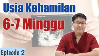 Detail Gambar Janin 6 Minggu Dalam Rahim Nomer 49