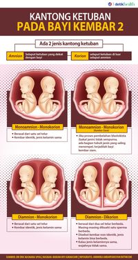 Detail Gambar Janin Kembar Nomer 48