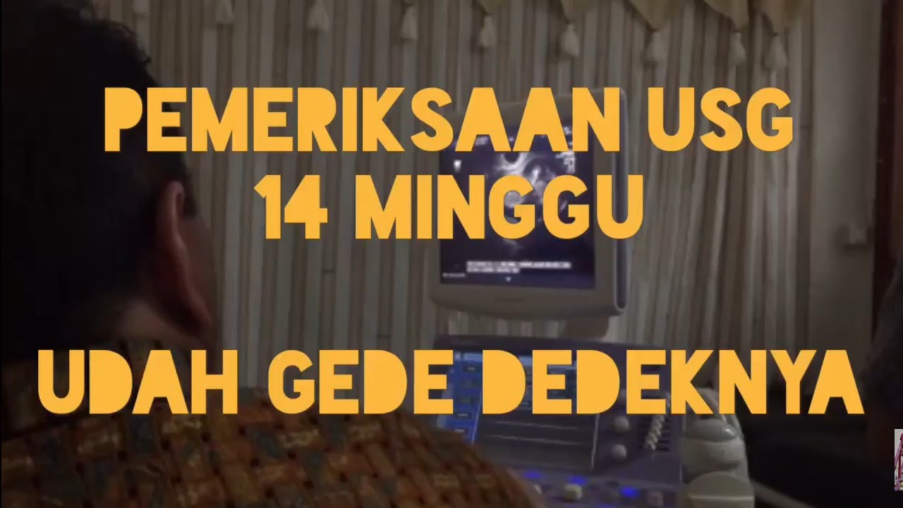 Detail Gambar Janin Usia 14 Minggu Nomer 42