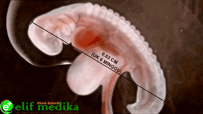 Detail Gambar Janin Usia 6 Bulan Nomer 37