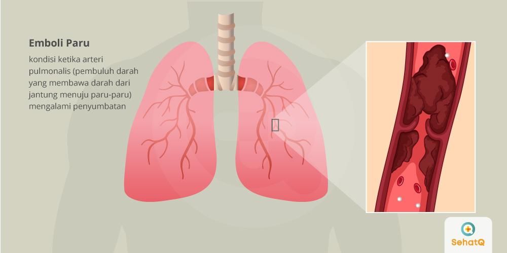 Detail Gambar Jantung Dan Paru Paru Nomer 48