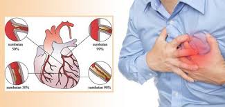 Detail Gambar Jantung Koroner Nomer 6