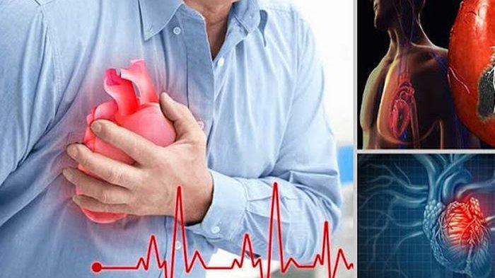 Detail Gambar Jantung Yang Mengalami Penyakit Jantung Koroner Nomer 46