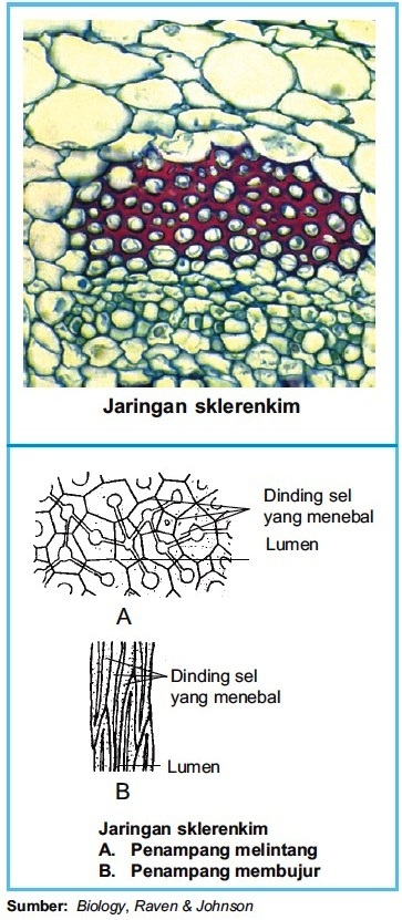 Detail Gambar Jaringan Sklerenkim Nomer 9