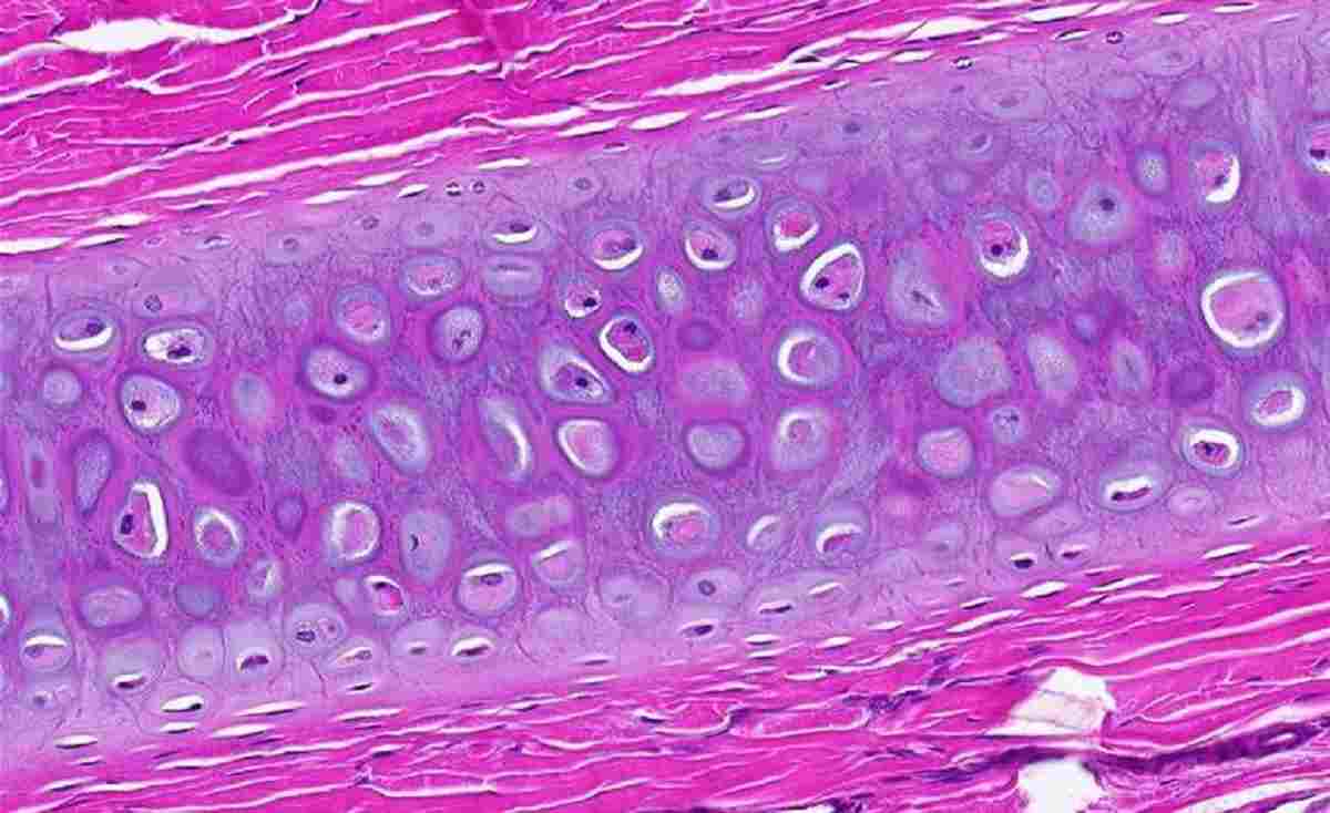 Detail Gambar Jaringan Tulang Rawan Nomer 2