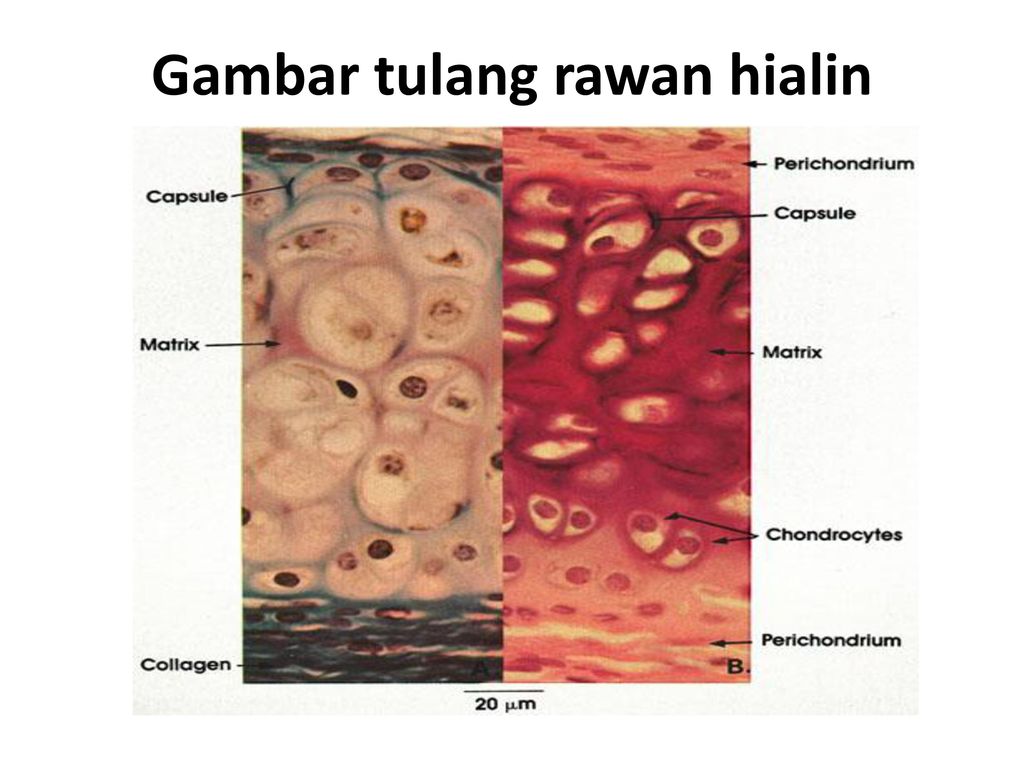 Detail Gambar Jaringan Tulang Rawan Nomer 29