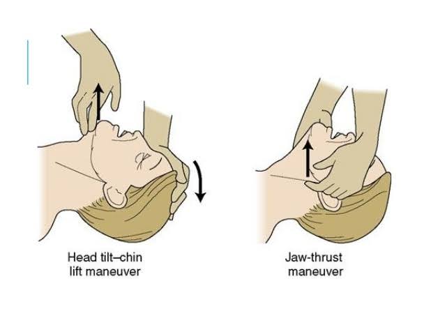 Detail Gambar Jaw Thrust Nomer 13