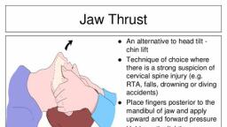 Detail Gambar Jaw Trust Nomer 12