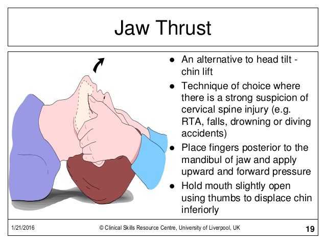 Detail Gambar Jaw Trust Nomer 6