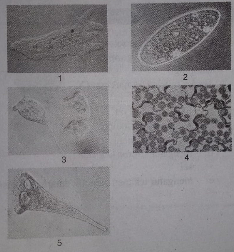 Detail Gambar Jenis Jenis Protozoa Nomer 49