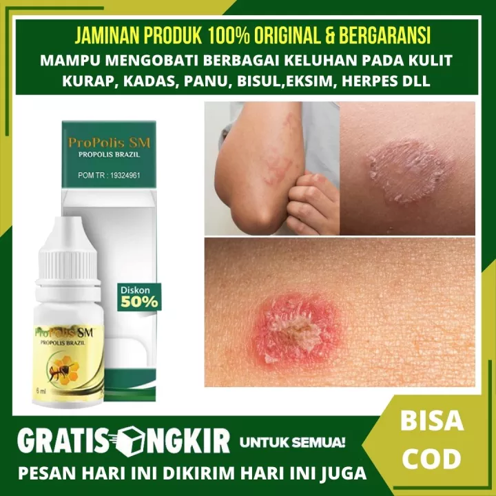 Detail Gambar Kadas Kulit Nomer 52