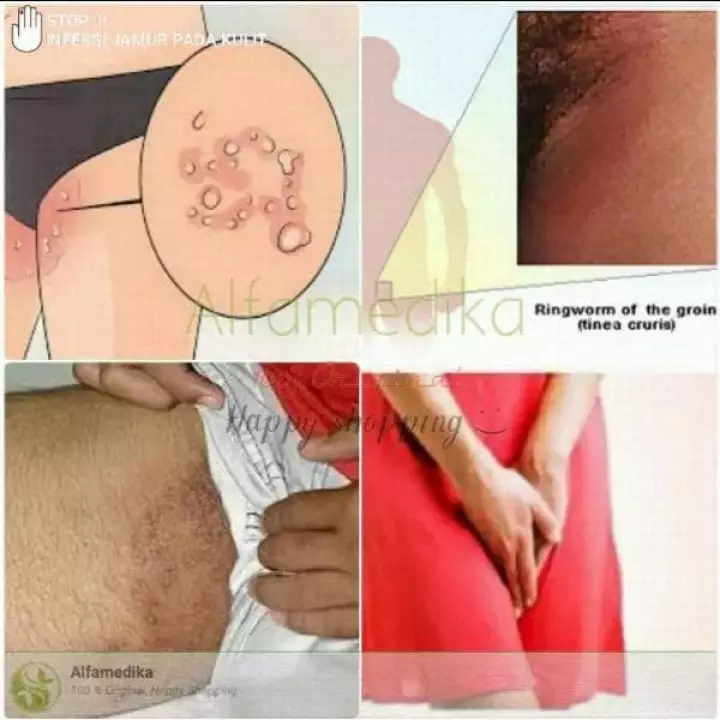 Detail Gambar Kadas Kulit Nomer 56