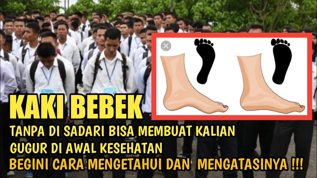 Detail Gambar Kaki Bebek Nomer 29