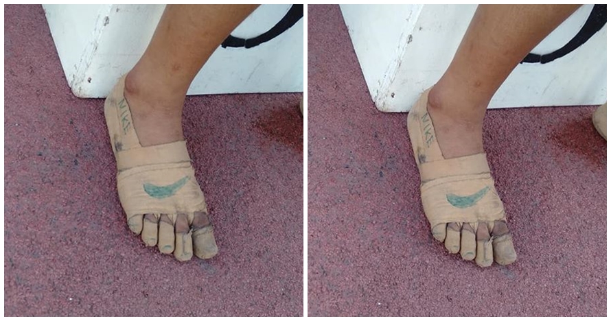 Detail Gambar Kaki Diperban Nomer 27