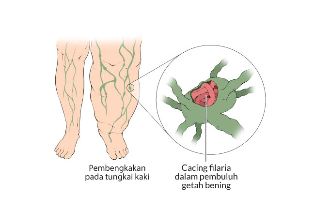 Detail Gambar Kaki Gajah Nomer 8