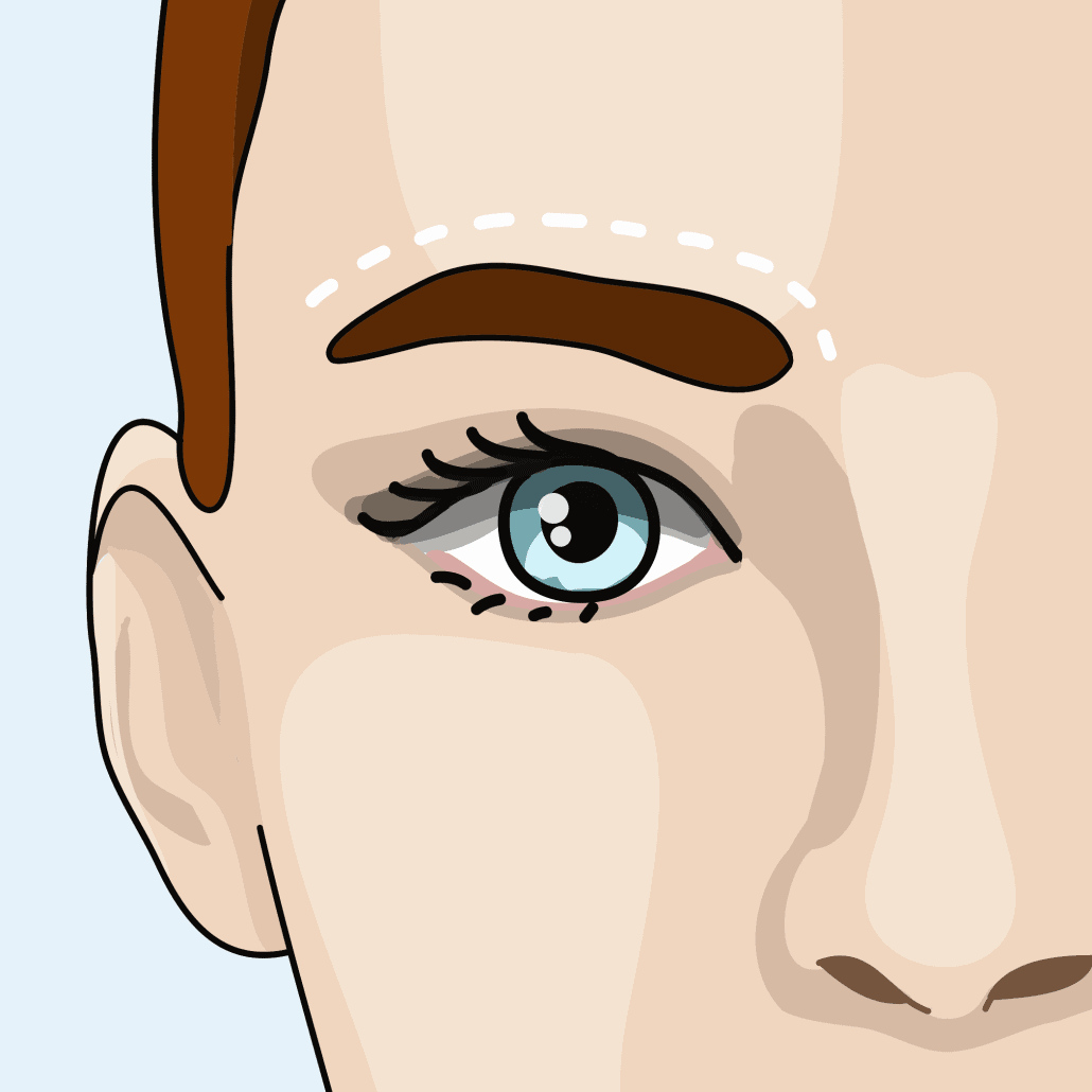 Detail Botox Mann Nomer 22