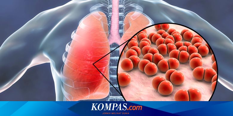 Detail Contoh Kasus Pneumonia Nomer 20