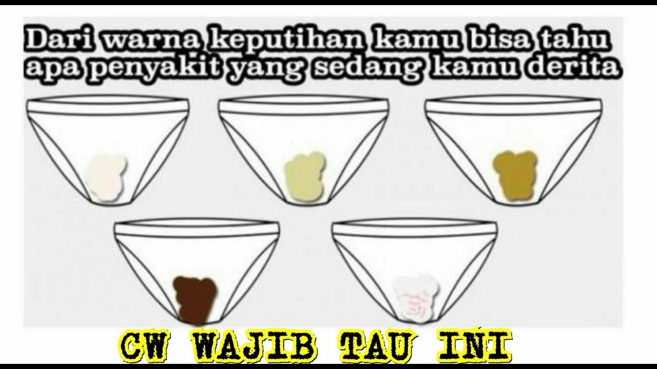 Detail Contoh Keputihan Berwarna Coklat Nomer 7