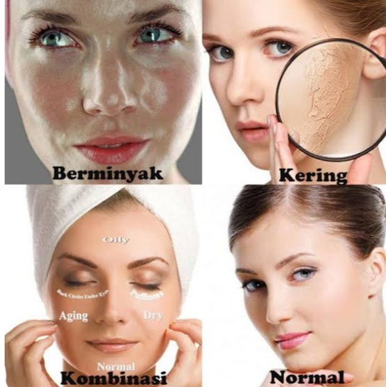 Detail Contoh Kulit Kering Nomer 37