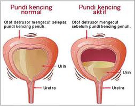 Detail Gambar Kandung Kemih Nomer 15