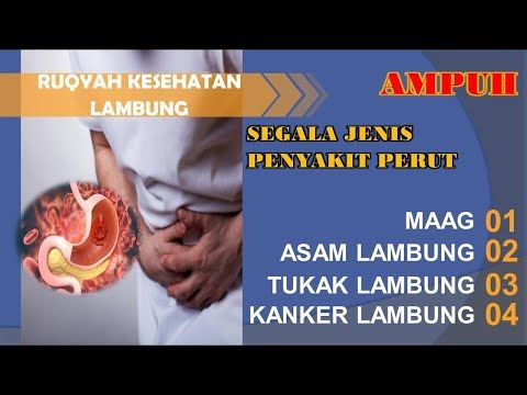 Detail Gambar Kanker Lambung Nomer 44