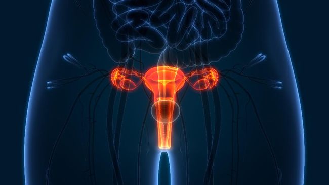 Detail Gambar Kanker Ovarium Nomer 36