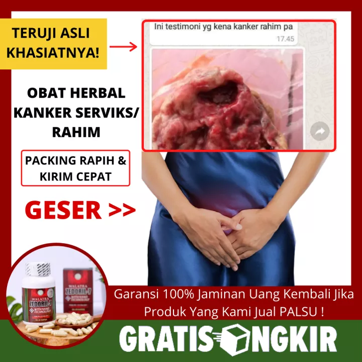 Detail Gambar Kanker Rahim Nomer 41