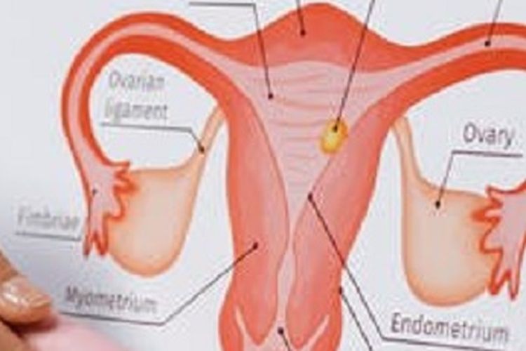 Detail Gambar Kanker Serviks Pada Wanita Nomer 30