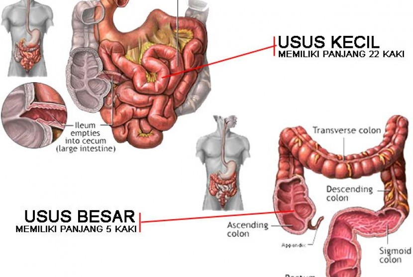 Detail Gambar Kanker Usus Nomer 13