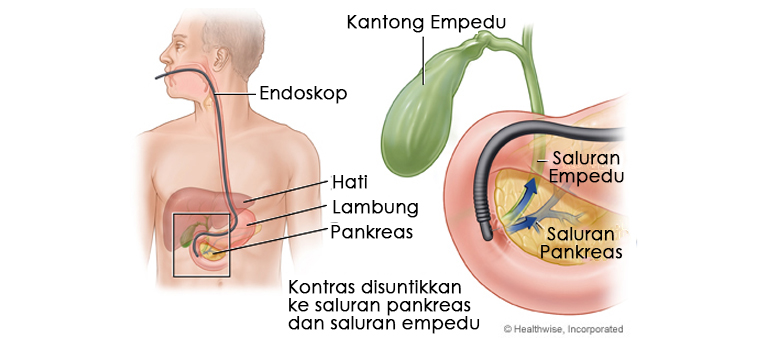 Detail Gambar Kantong Empedu Nomer 29