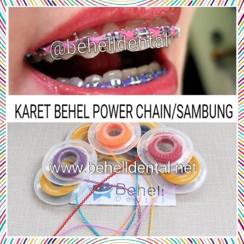 Detail Gambar Karet Behel Nomer 15