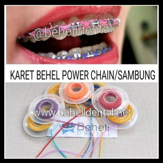 Detail Gambar Karet Behel Terbaru Nomer 2