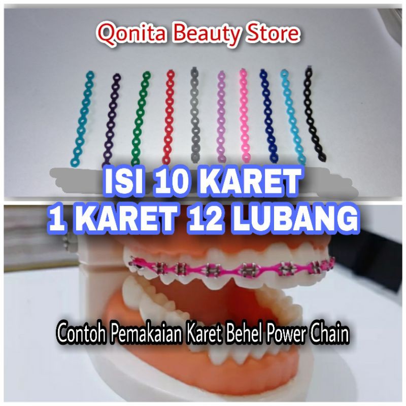 Detail Gambar Karet Behel Terbaru Nomer 27