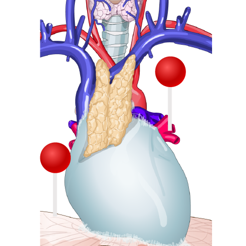 Wo Sind Lymphknoten Am Hals? Quick Answers To Your Biggest Concerns - z6sk9ti
